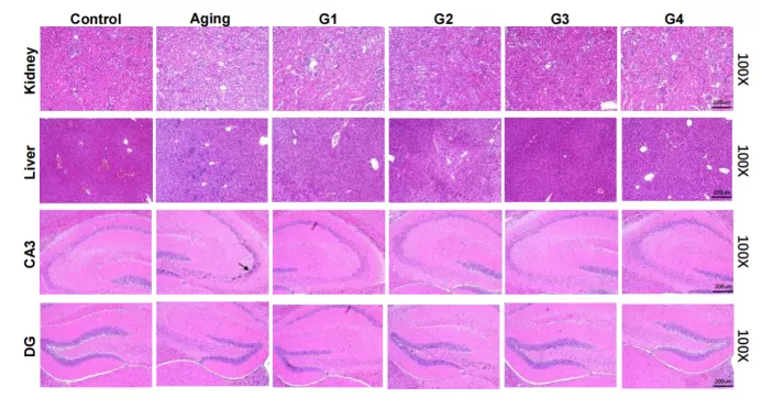 keputusan yang menarik dalam Model penuaan semulajadi