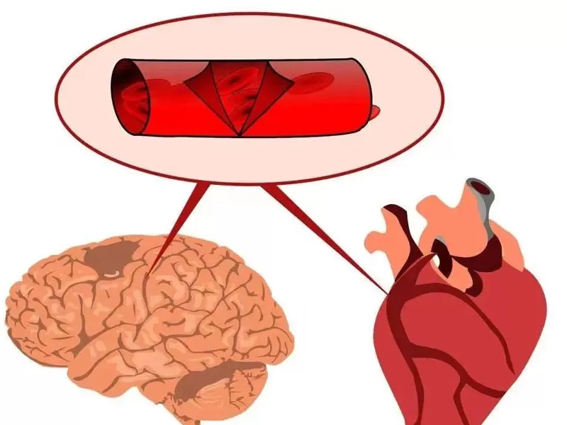 Siri Anti-penuaan: Resveratrol