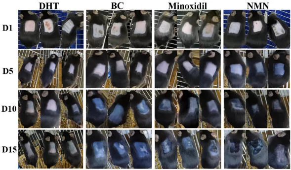 NMN dan pertumbuhan rambut: bukti baru dalam Androgenetic Alopecia (AGA)